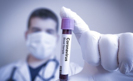 فيروس كورونا: نتائج واعدة للتجارب على لقاح روسي