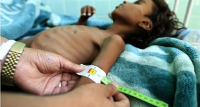ما بين الاغتيالات و الاختطافات والحروب…”اليمن” يواجه شبح المجاعة و خسارة ملايين الأرواح
