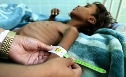 ما بين الاغتيالات و الاختطافات والحروب…”اليمن” يواجه شبح المجاعة و خسارة ملايين الأرواح