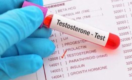 يسبب العقم.. أعراض ارتفاع هرمون الذكورة “التستوستيرون” عند النساء