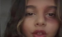 تحتفل بالهالووين| نكشف حقيقة تورم «عين» إبنة شيرين عبد الوهاب