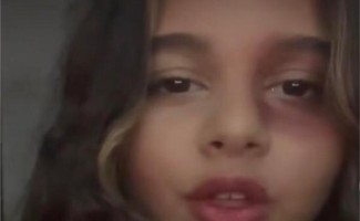 تحتفل بالهالووين| نكشف حقيقة تورم «عين» إبنة شيرين عبد الوهاب